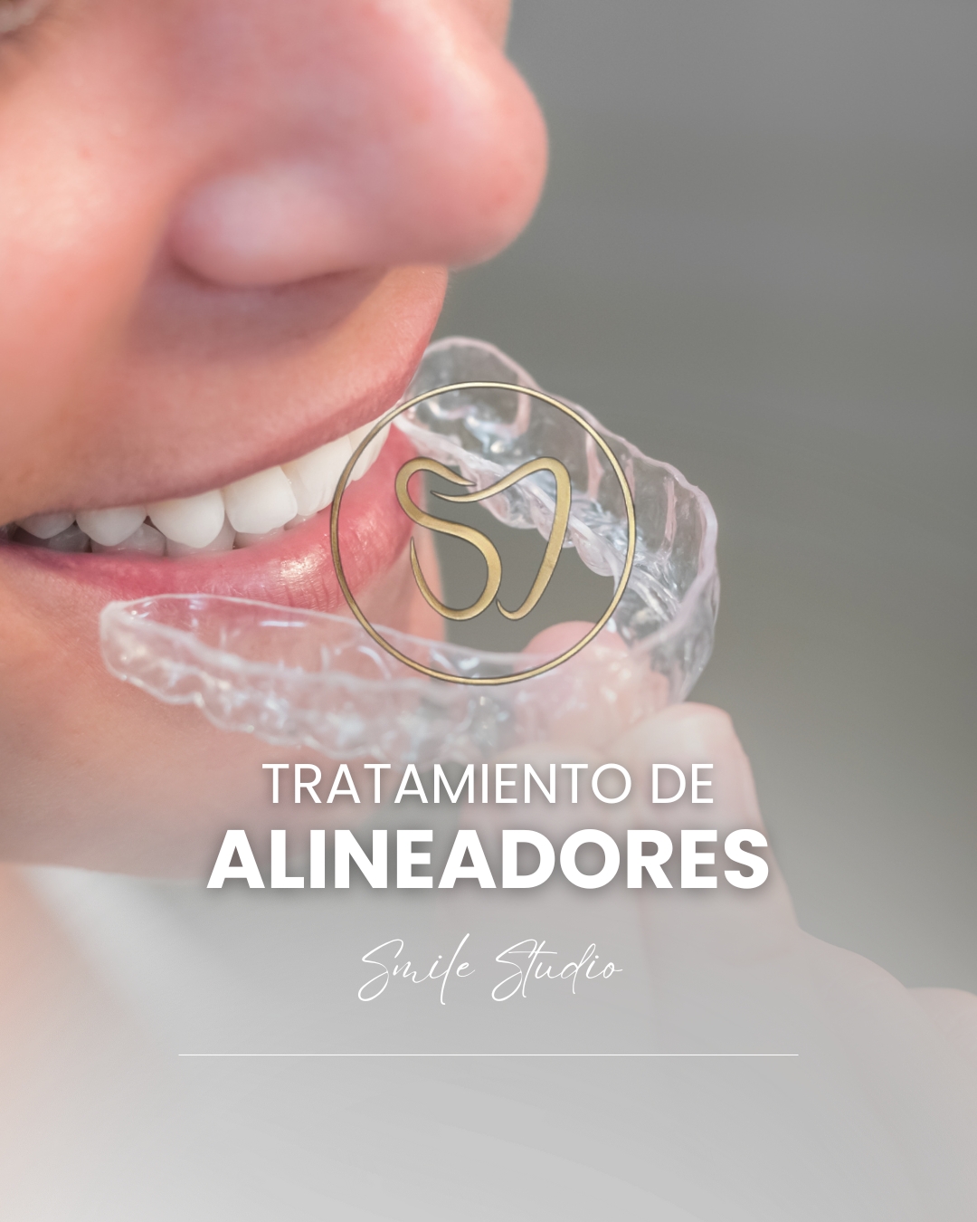Tratamiento de alineadores
